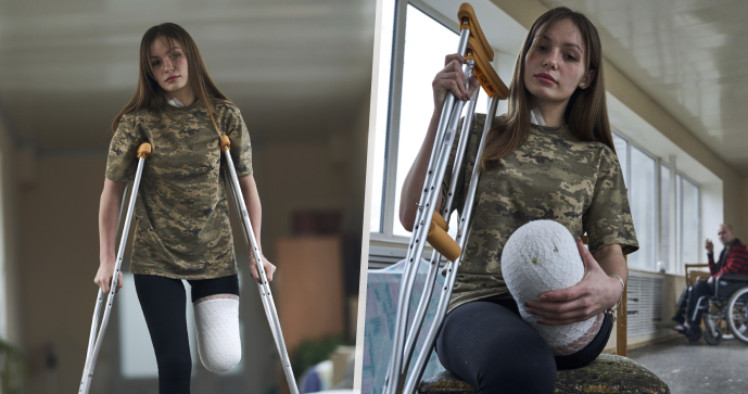 Ruslana (19) přišla v bojích o nohu. Ani přesto se nevzdala.
