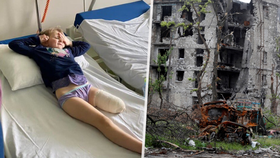 Maryna (5) přišla kvůli bombardování o nohu.