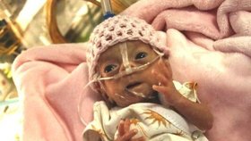Vaneska se v olomoucké nemocnici narodila jako vůbec nejmenší miminko. Vážila 395 gramů.