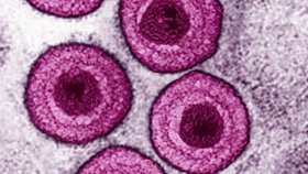 Varicella zoster virus