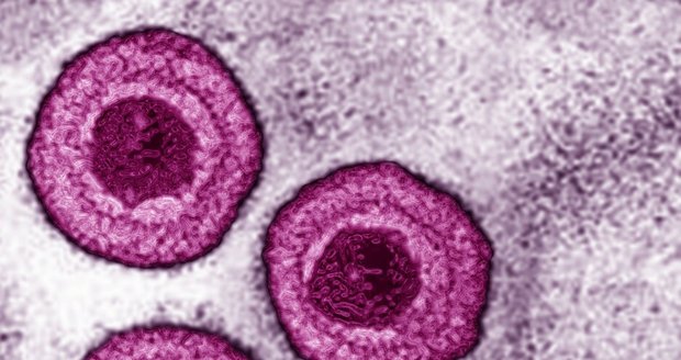 Varicella zoster virus 