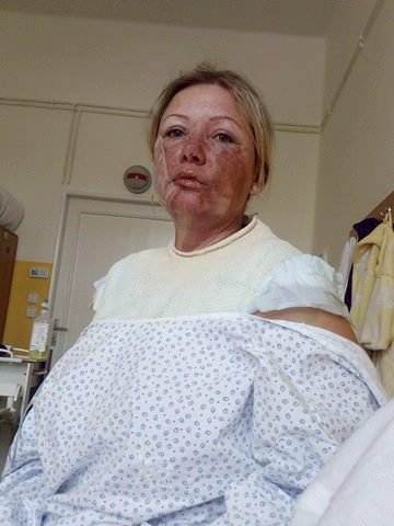 Takto Markéta po útoku dopadla. Markéta M. byla hospitalizována na tomto oddělení teplické nemocnice. Včera ráno ji odtud propustili.