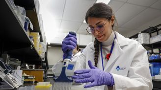 Přelomový objev, který změní pohled na stárnutí. Biologické hodiny fungují jinak, než se předpokládalo Přelomový objev, který změní pohled na stárnutí. Biologické hodiny fungují jinak, než se předpokládalo