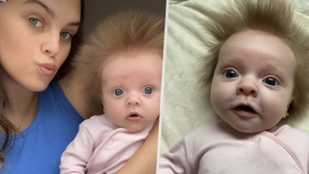 Malé holčičce rostou vlasy zvláštním způsobem: Baví celý internet 