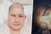 Onkologická pacientka (†30) své tělo věnovala vědě: Rozpitvali ji před kamerou!