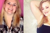 Žena zoufale touží po zmenšení prsou: Neuvěřitelně ji bolí záda a muži ji obtěžují
