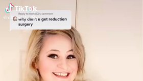 Uživatelka TikToku Hollie Bee z Velké Británie ve svých videích odhaluje problémy, které má kvůli svým nadměrně velkým prsům
