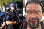 Venezuelská policie brutálně zbila polského novináře Tomasze Surdela (vpravo), snímek policisty je ilustrační.