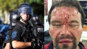Venezuelská policie brutálně zbila polského novináře Tomasze Surdela (vpravo), snímek policisty je ilustrační.