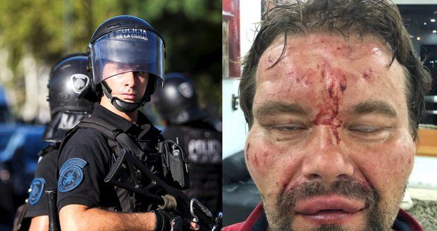 Pytel na hlavě, hlaveň před očima. Poláka brutálně zbila policie ve Venezuele