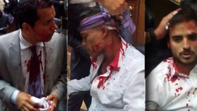 Při útoku byli zraněni poslanci a novináři.