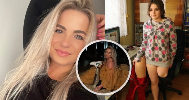 Věrka Závorková v pubertě přišla kvůli rakovině o nohu. Jak se jí žije jako dospělé ženě?