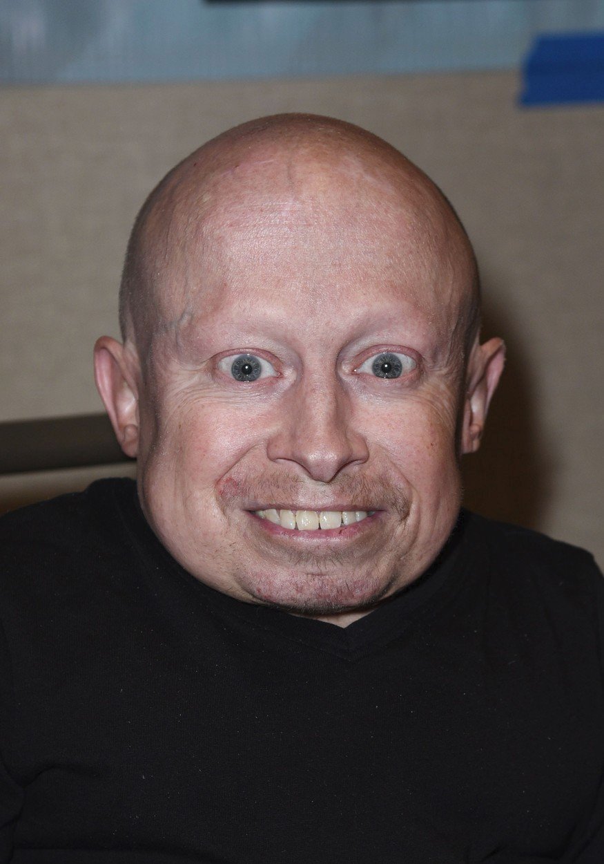 Malý herec Vern Troyer (†49) zemřel po boji s depresemi.