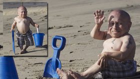 Troyer, který měří 81 centimetrů, natáčel na pláži