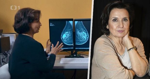 Veronika Freimanová promluvila o rakovině.
