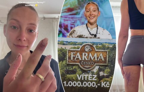 Výhra vykoupená krví! Veve a její suvenýry z Farmy: Neskutečně dobité tělo!