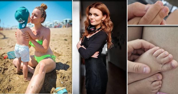 Syn Veroniky Stýblové musí na operaci kvůli srostlým prstům!
