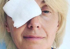 Veronika Žilková s obvazem přes oko