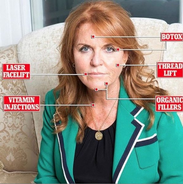 Královská rodina zuří: Fotografie vévodkyně Kate byly zneužity estetickou klinikou, kterou navštěvuje Fergie!