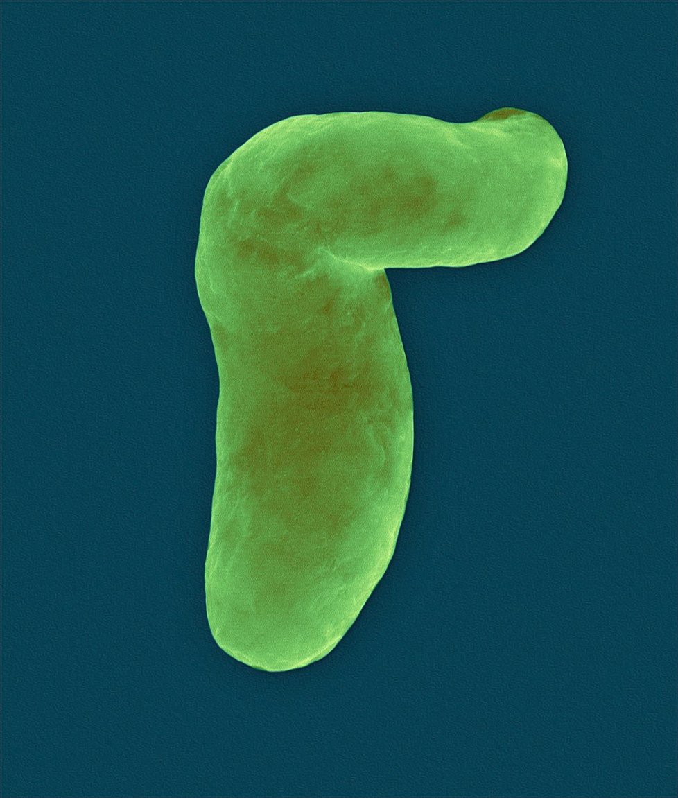 Nebezpečná bakterie Vibrio Vulnificus.