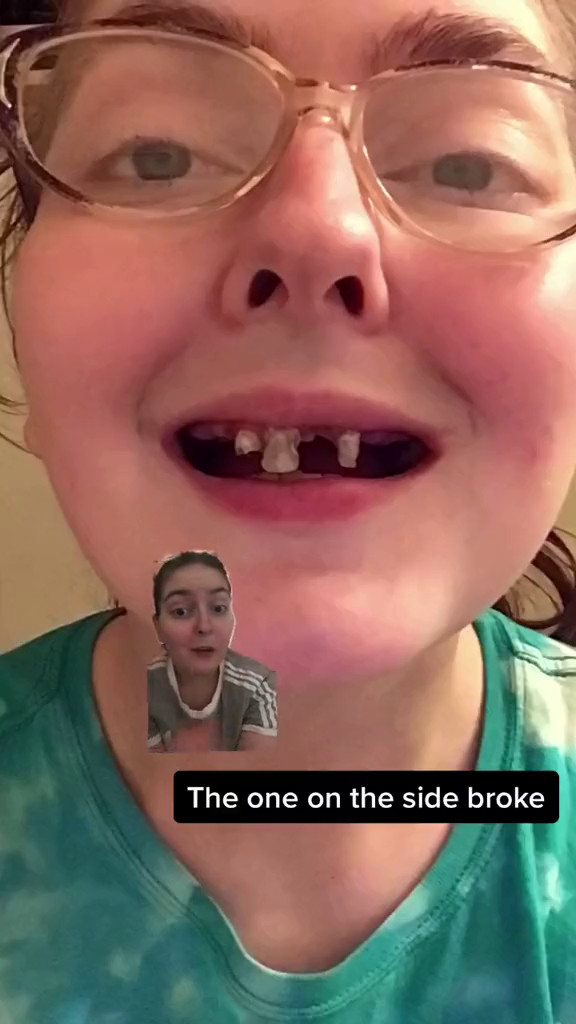 Victoria Nowakowskiová na videu zmapovala, jak jí shnily zuby kvůli pití limonády. Žena poté podstoupila jejich vytrhání a pořídila si zubní náhradu.