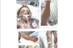 Kaitlyn uveřejnila fotografie z nemocnice. Zde ještě nebylo jasné, zda napadení virem meningokoka přežije