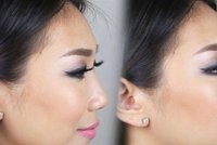 Šokující kosmetický hit: Upravte si nos bez plastické operace!
