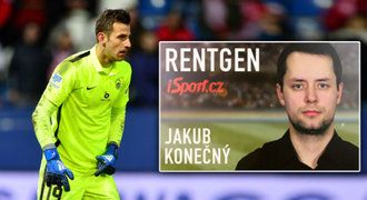 RENTGEN: Liberecký Dúbravka splňuje parametry špičkového moderního gólmana