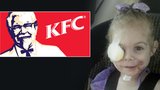 KFC tvrdí, že znetvořenou Viktorku (3) z restaurace kvůli vzhledu nikdo nevyhodil!