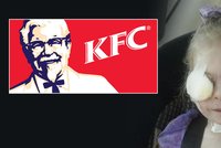 KFC tvrdí, že znetvořenou Viktorku (3) z restaurace kvůli vzhledu nikdo nevyhodil!