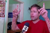 Čech Vilém zmizel v brazilské džungli: Nohy mu žrali masožraví červi. Našli ho po 5 dnech
