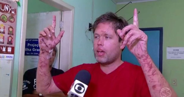 Čech Vilém zmizel v brazilské džungli: Nohy mu žrali masožraví červi. Našli ho po 5 dnech