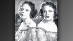 Violeta a Daisy Hilton byly náruživé milovnice