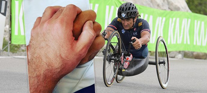 Alex Zanardi bojuje v nemocnic v Sieně o to nejcennější, co má - zrak