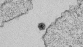 Záhadný yaravirus byl objevený v rybníce v Brazílii