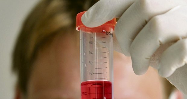 Laboratoře po celém světě mají plné ruce s vyhodnocováním vzorků od lidí s podezřením na prasečí chřipku