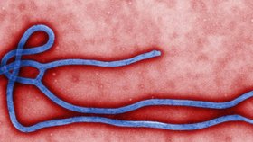 Ebola (ilustrační foto)