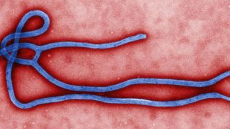 Vědci jsou na stopě léku proti ebole