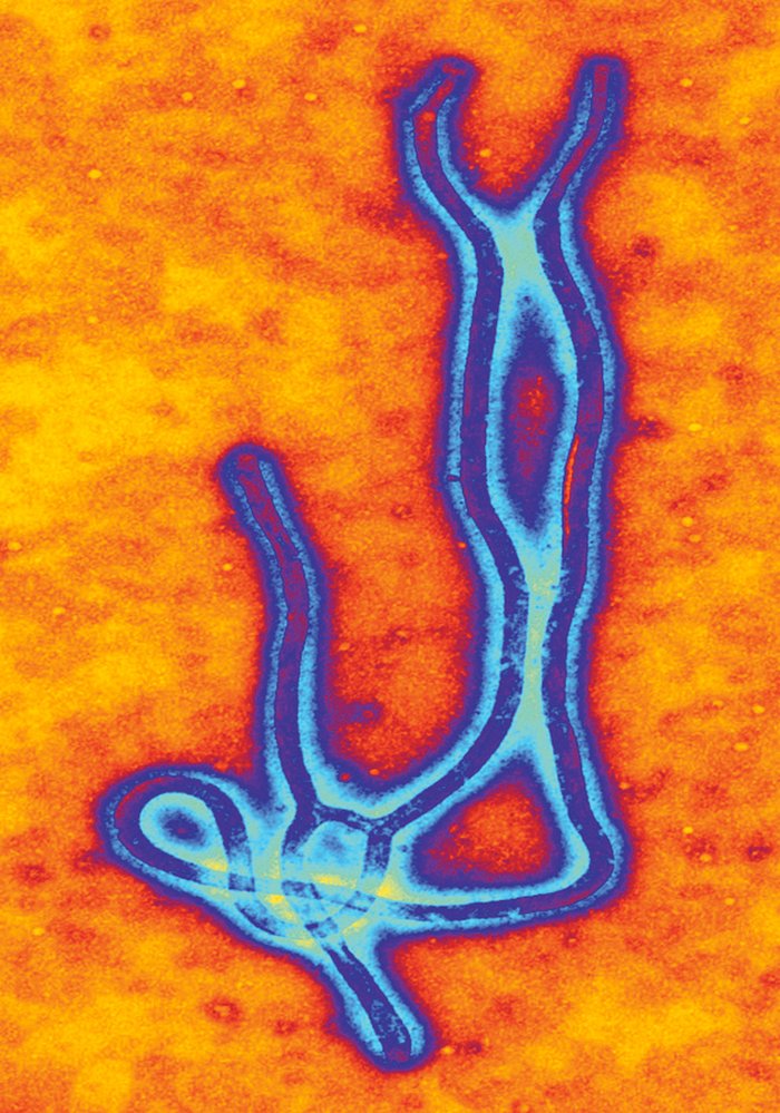 Obarvený snímek viru eboly z elektronového mi- kroskopu