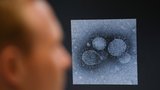 Smrtící virus marburg děsí WHO: Začal se šířit v nové zemi, přenáší ho netopýři