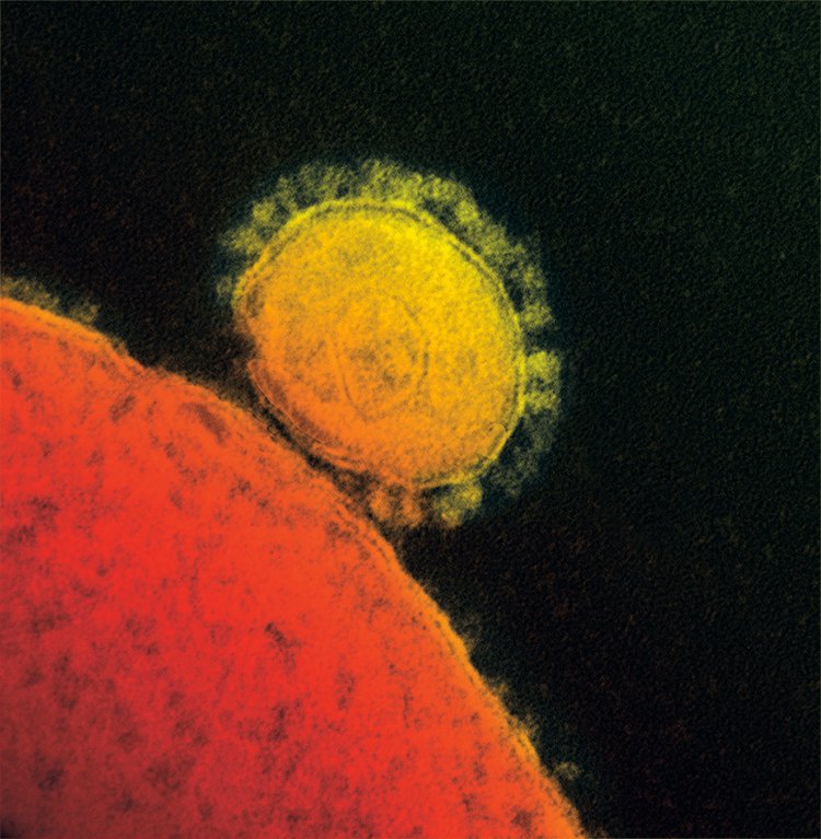 Virus MERS přichycený k povrchu buňky