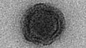 Yravirus, dosud geneticky zcela neznámý organizmus.