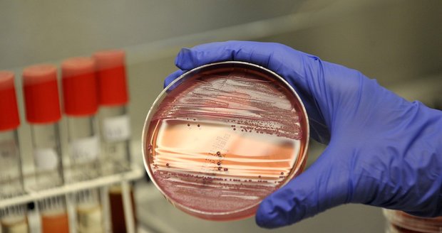 Bakterie možná zmutovala a vznikl nový patogen číslo 43