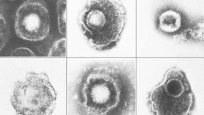 Různé druhy herpesvirů nasnímané elektornovým mikroskopem