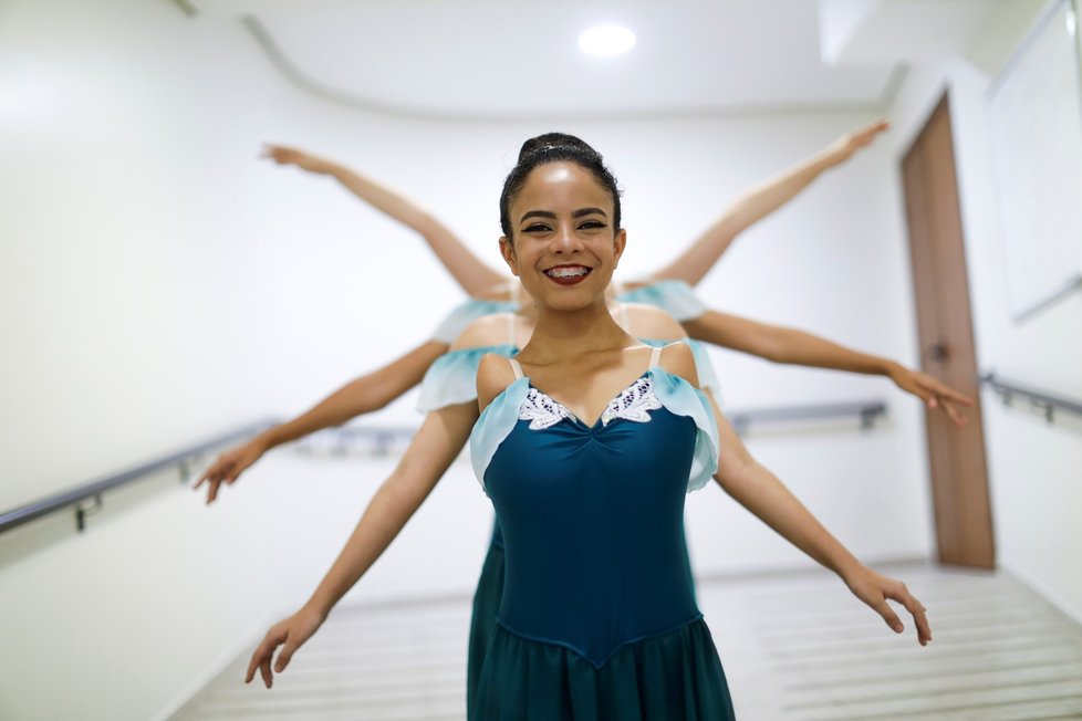Brazilka Vitoria (16) uchvacuje: baletí nádherně i bez rukou! Sama se nohama i líčí nebo si čistí zuby.