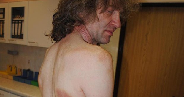 Takto dopadl Vladimír Kummer (54) z Aše po napadení policisty.