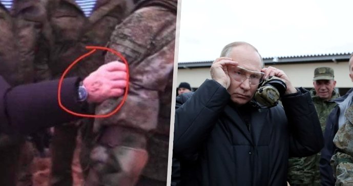 Vladimir Putin’s Health: Mysterious freckles appear on his hands!