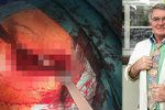 Vlastimil Harapes podstoupil operaci kyčle a pochlubil se fotkou z operačního sálu.