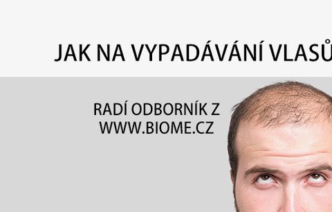 Příčiny, příznaky a léčba vypadávání vlasů