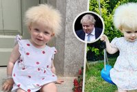 Holčička se narodila se vzácnou genetickou poruchou: Vypadá jako Boris Johnson!